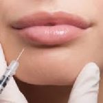 We can offer 0.5ml, 1ml or 2ml filler to volumise and shape your lips