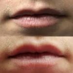 Lips, Lips, Lips